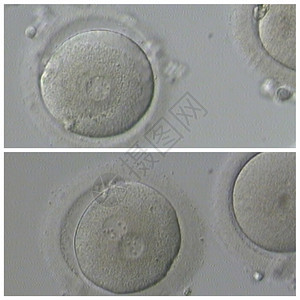 基因人类体外受精子生殖图片
