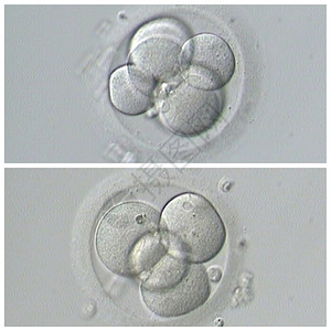 生殖基因育力人类体外受精图片