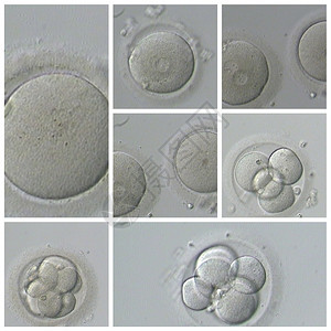 施肥细胞人类体外受精生殖图片