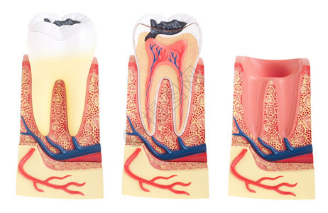 白底隔离的重要牙齿结构骨骼颈部和套接塞以白色背景隔离牙医衰变胶图片