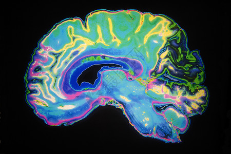 精神的磁人脑工彩色核磁共振成像仪扫描水平的图片