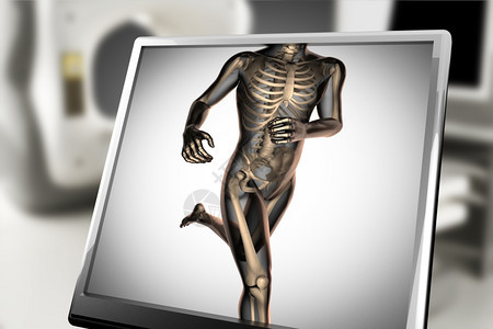 X射线科学X扫描X光图像骨质疏松症图片