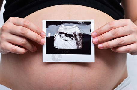 年轻的孕妇展示B超单图片