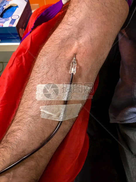 专业知识接收捐赠者献血输时的者在医院接受液的商人右臂特写医疗保健和慈善机构也是世界献血者日的概念图像背景6月14日图片