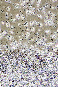 医疗的疾病细胞器Colon癌症细胞在组织培养中的显微镜示墙壁核心和器官图片