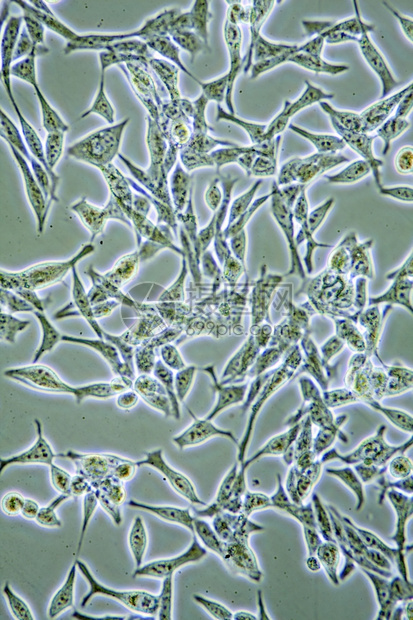 增殖的组织培养中前列腺癌细胞显示墙壁核心和器官的显微镜以示克隆进步图片