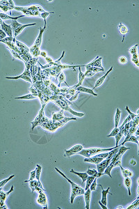 组织培养中前列腺癌细胞显示墙壁核心和器官的显微镜以示增殖的摄影细胞器图片