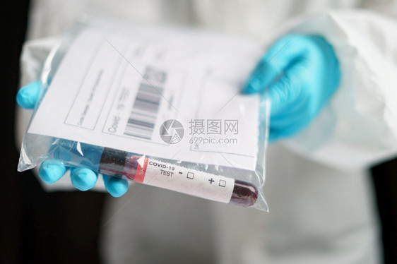 透明袋中的血液样本特写COVID19冠状血样本医生品等离子体图片