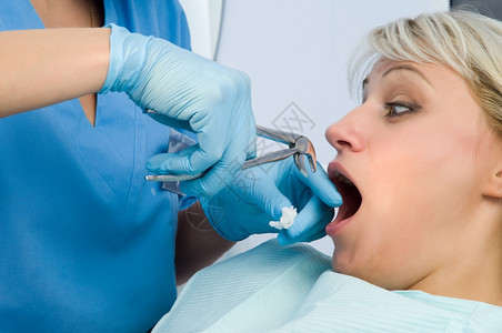 口服牙疼使用警力抽取牙齿惊吓病人抽取惊吓病人医院图片