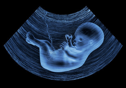 轮廓新生扫描婴儿在母量子宫中的超声波形象图片