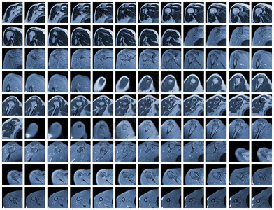 右肩关节全磁共振联合的人类末端图片