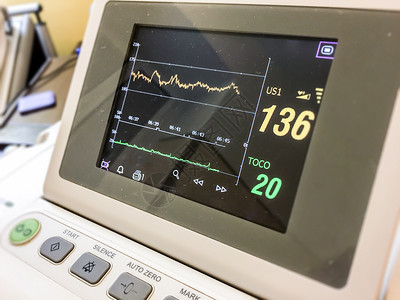 关心象征科学用于测量医院心率的屏幕监视器图片