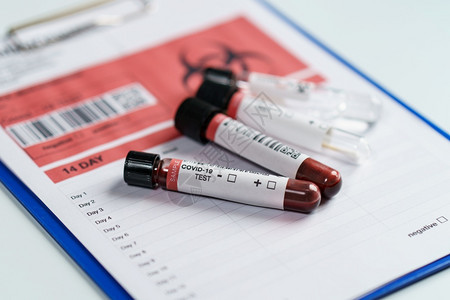 实验室里的血液样本与听诊器图片