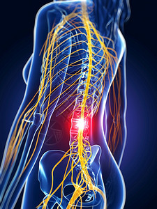 触碰丛系统3d提供了医疗说明背痛图片