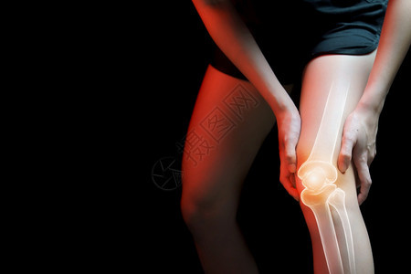 遭受联合的医疗学概念膝盖疼痛的妇女骨骼X光图片