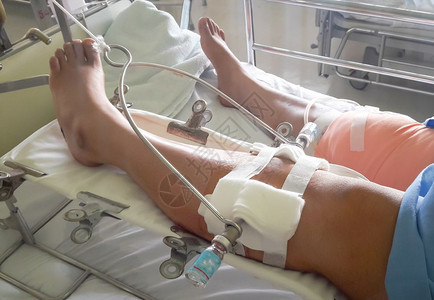 腿部受伤治疗的病人图片