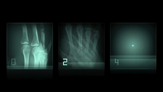 健康3d插图黑色背景的X光面板黑色骨骼图片