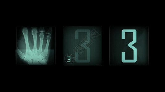 医生3d插图黑色背景的X光面板医师药物图片