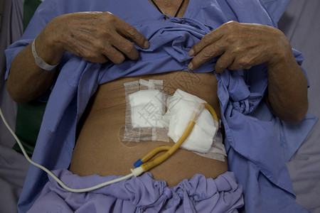 外展在医院床上躺着的病人胃部躺在医院床上药物食管背景图片