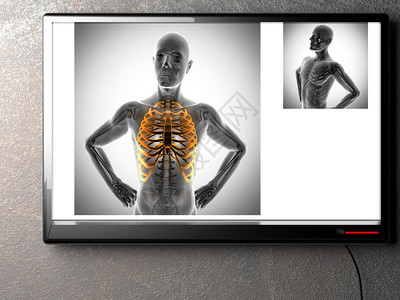 病人X射线扫描X光图像背痛放射学图片
