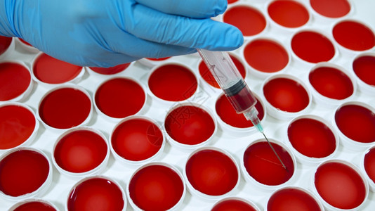 实验室生物学测试一只带着蓝色手套的男人特写拿着一个行话从白色表面上圆形容器中的一组临床样本中抽取红色液体样本一组圆形容器中的临床图片