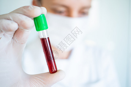 流行病持有验血试样的冠状腺女医生测试护士图片
