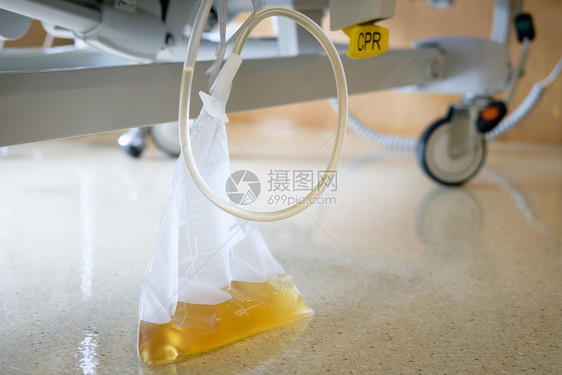 在医院的病人床下挂在塑料尿袋收集内AF点选择肾脏病学心肺复苏术透明图片