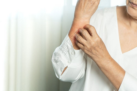 咸菜疙瘩皮肤科高龄妇女手痒系于脏手臂保健和医药概念上皮疹炎背景