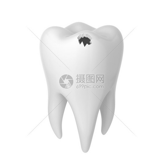 嘴关心恢复白背景上孤立的牙洞3D插图图片