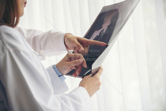 女医生讨论X光片图片