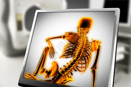 X射线扫描人体图像背景图片
