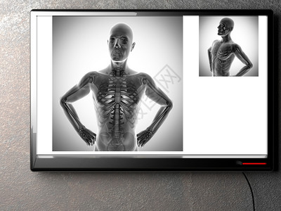 X射线扫描人体图像背景图片