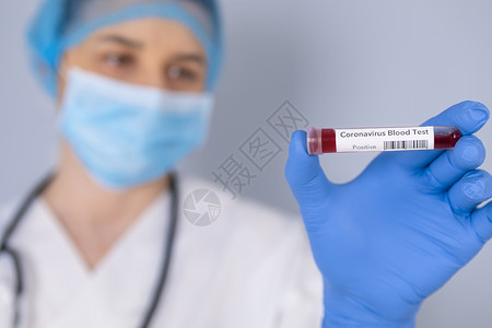 Corona检验血液样本测试和研究概念Focus是针对血液测试管子的重点在血液测试管上微生物学积极的手套图片