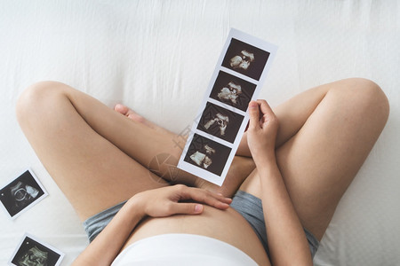 孕妇看着超声波图抚摸肚子里的婴儿图片