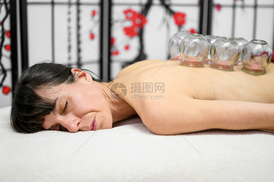 进行中医拔罐治疗的女性图片