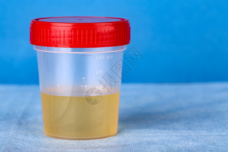 含有尿液分析的塑料容器带有尿液分析的塑料容器药物肾实验室图片