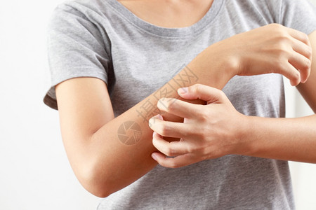 敏感肌肤无刺激健康有问题女人手痒生病的疮皮炎背景