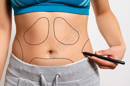腹部皮肤一个女人用白色背景在她身体的乳液抽取区上显示一条虚线个女人用她的体内脂液抽吸区展示一条虚线脂肪团图片