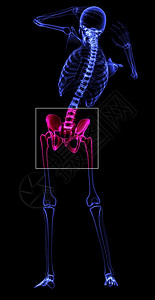 联合的仅有女士3D软件制造的疼痛臀部图片
