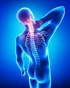 躯干科学生物3d男颈部疼痛蓝色图片