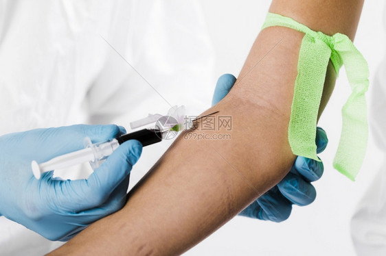 医生从病人身上抽取血样特写图片