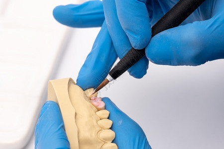 假牙嘴工作科技术员在其实验室内使用陶瓷牙植入器刷图片