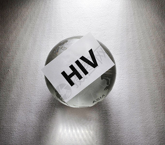 全球艾滋威胁和全球警报的HIV标签感染医疗的实验室高清图片