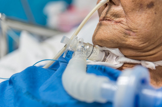 做气管切除术的老年人躺在医院重症病房图片