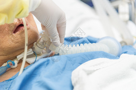 做气管切除术的老年女性躺在医院重症病房图片