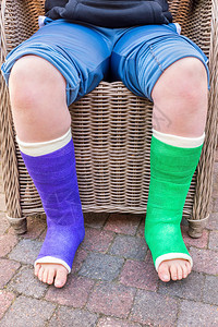 医疗的荷兰断裂青少年男孩坐在椅子上外面有两条彩色石膏腿图片