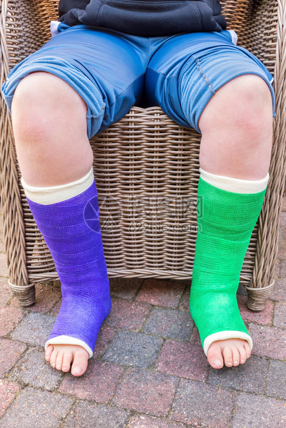 医疗的荷兰断裂青少年男孩坐在椅子上外面有两条彩色石膏腿图片
