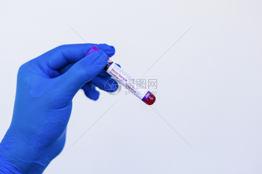 一名戴手套的初级医生其冠状验血结果呈阳实验室医疗的图片