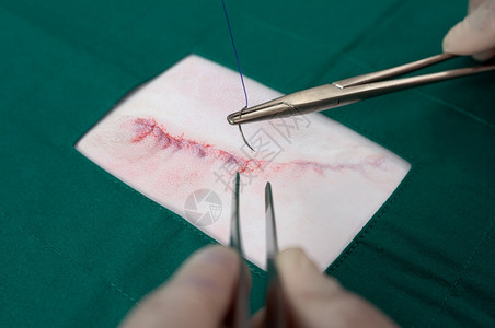 夹子伤害动物在用绿围裙缝合狗的外科伤口时给狗做小手术切口向狗进行小切伤手术图片