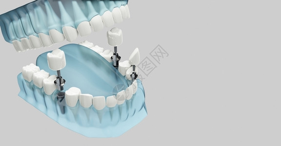 蓝色透明3D插图颜色透明3d插图嘴橹牙齿图片